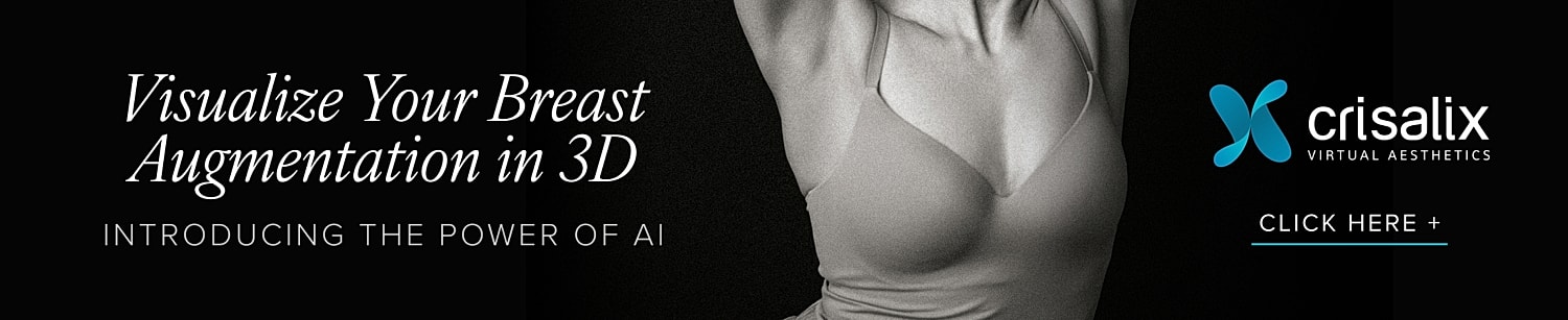 3D breast augmentation visualization with AI technology.