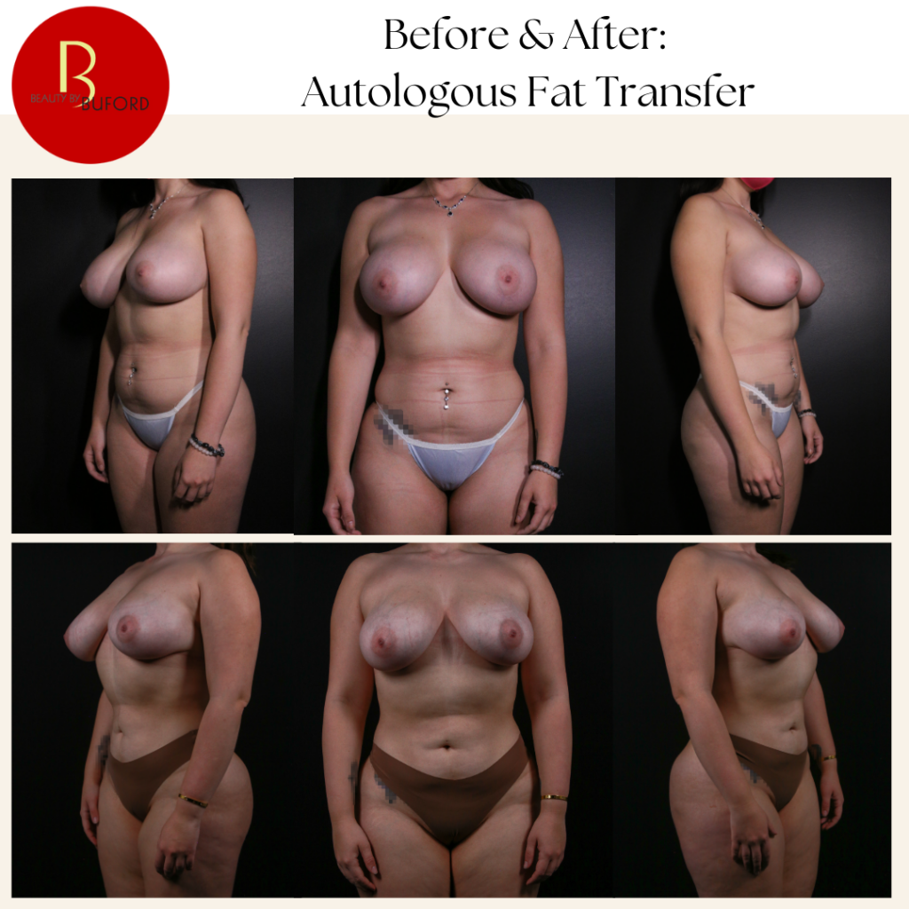 Body Procedures Before & After