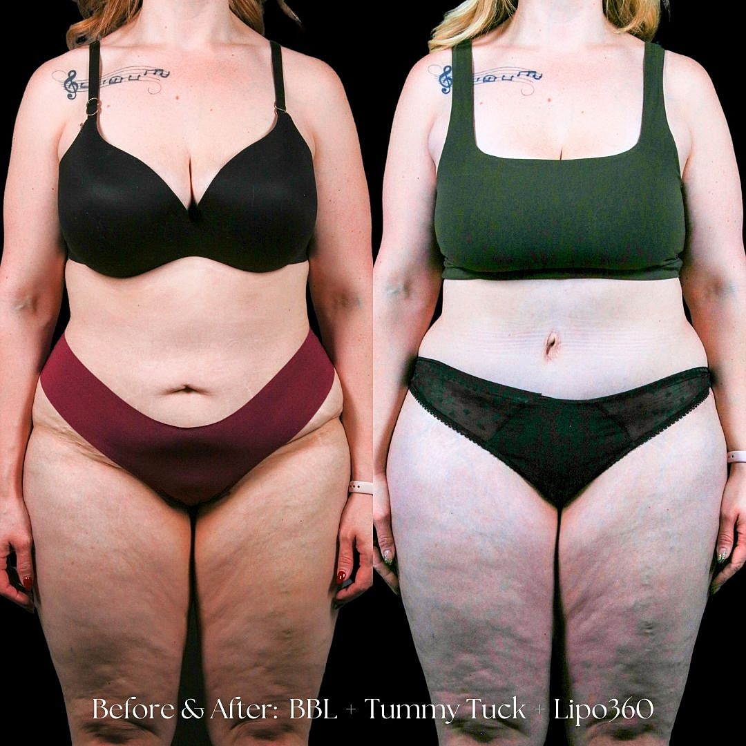 Before and after body transformation images.