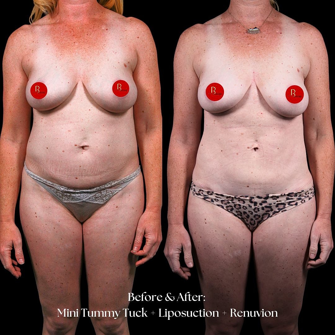 Surgical transformation before and after photos.