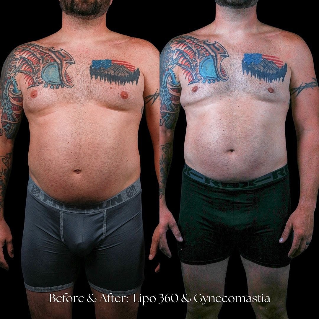 Before and after body transformation photo.