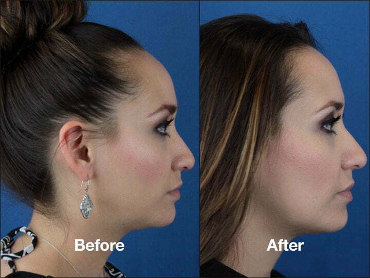 See more before and after photos of our patients
