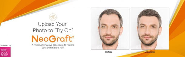 Upload Your Photo to "Try On" NeoGraft