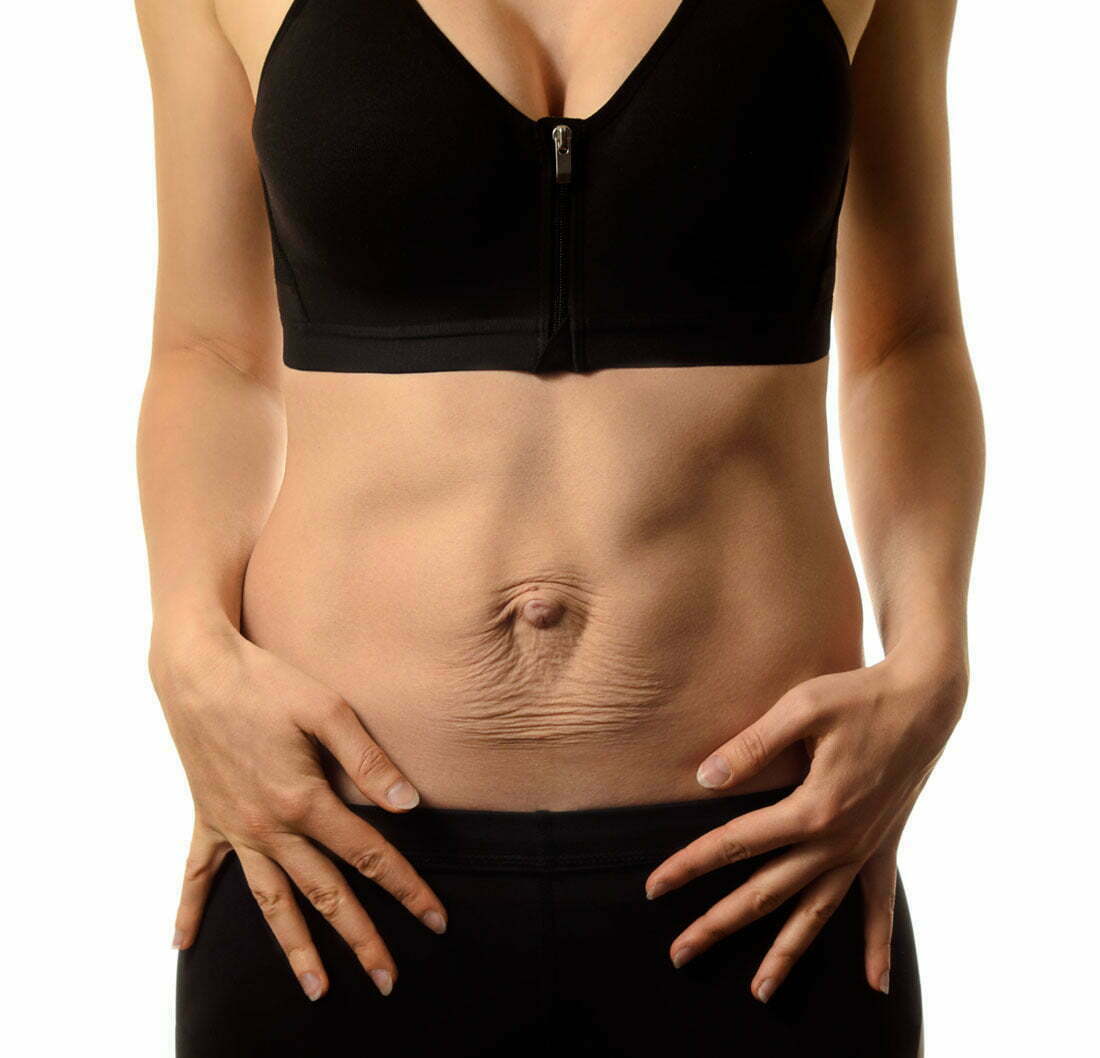 Deep Belly Flattener: Get Rid of the Pooch and Fix Diastasis Recti